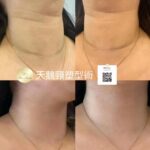 Ritz Beauty (荃灣美容)